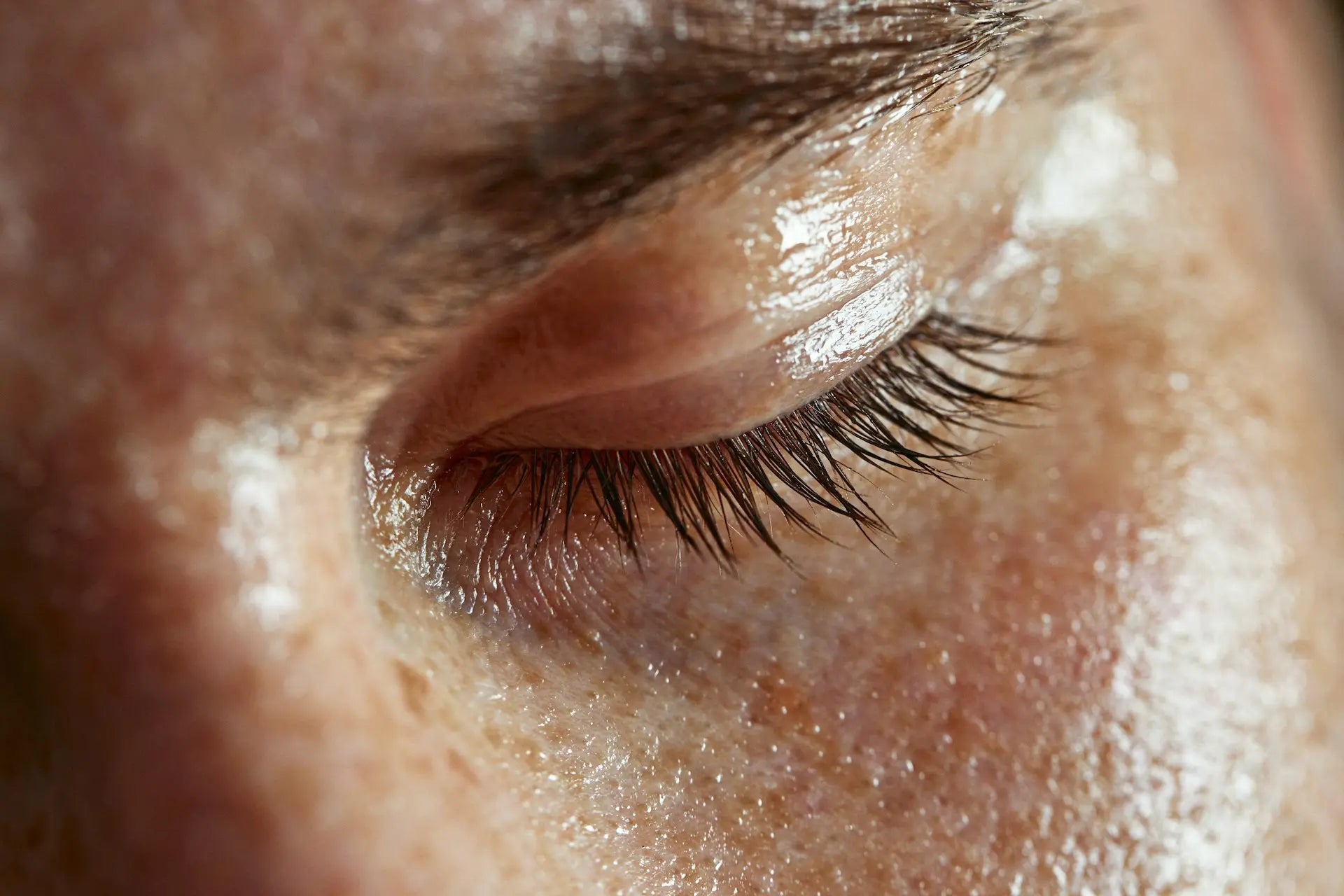 Skin Health